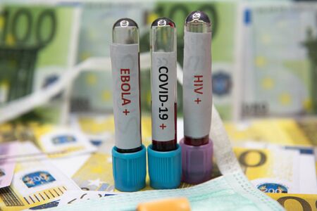 Euro money banknote as symbol economic recession..の写真素材