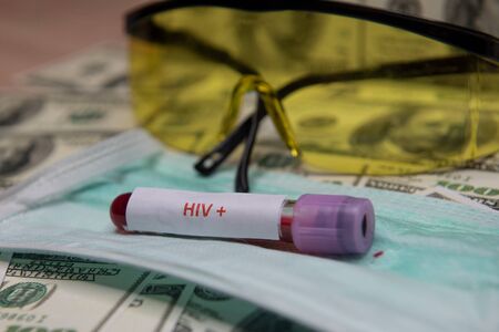 Dollars money and tube with blood and positive test at HIV.の写真素材