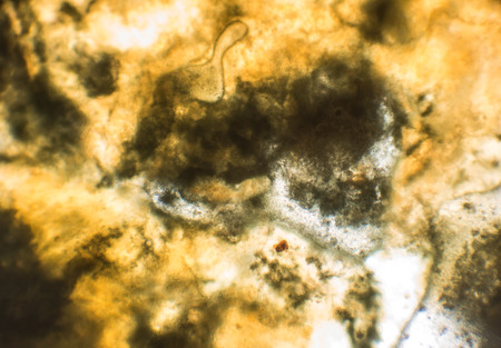 Moldy onion bulb, microscope viewの写真素材