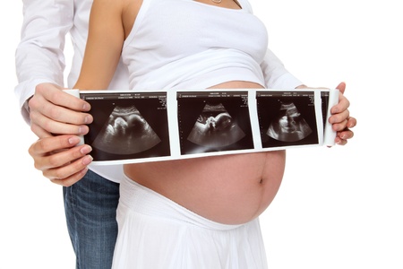 Young pregnant couple expecting a child holding ultrasoundの写真素材