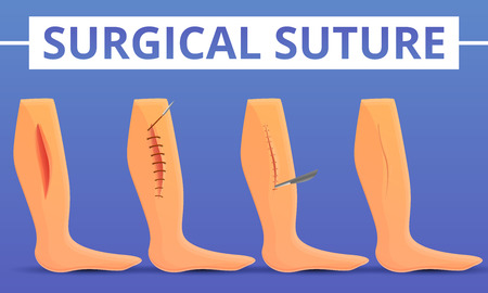 Medical suture concept background. Cartoon illustration of medical suture vector concept background for web designのイラスト素材