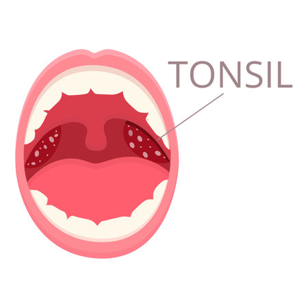 Mouth tonsillitis icon cartoon vector. Bacterial hygiene. Cancer medicalのイラスト素材
