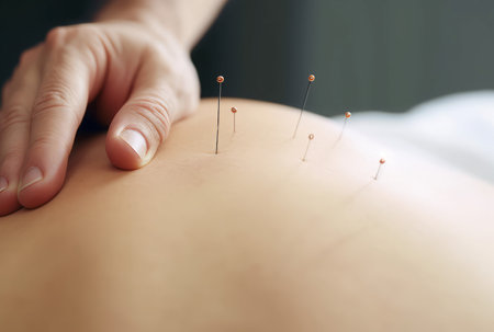 Acupuncture treatment needles. Traditional female spa. Generate Aiの素材