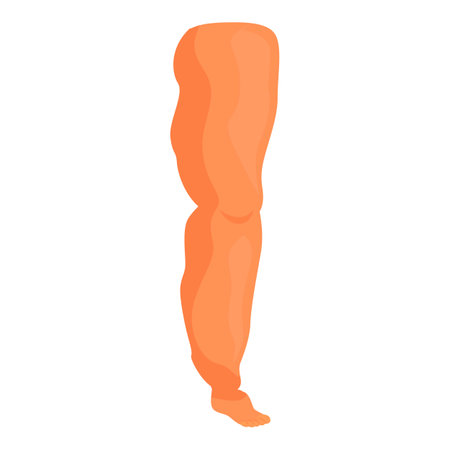 Cartoon illustration of a human leg with elephantiasis, highlighting the swelling and deformation of the lower limbのイラスト素材