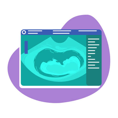 Fetal ultrasound 2D vector isolated illustration. Checking unborn baby condition flat sticker on cartoon background. Imaging pregnancy. Sonogram colorful scene for mobile, website, presentationのイラスト素材