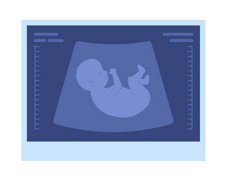 Fetal ultrasound picture semi flat color vector object. Pregnancy progress. Editable icon. Full sized element on white. Simple cartoon style spot illustration for web graphic design and animationのイラスト素材
