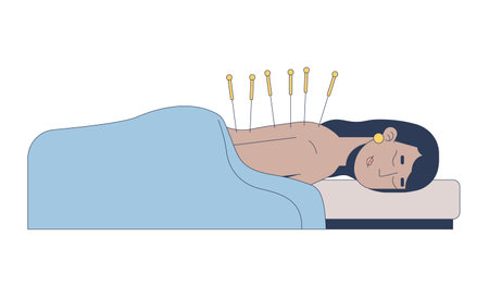 South asian woman receiving acupuncture therapy 2D cartoon character. Indian female lying on massage table under blanket with needles flat vector person isolated on white. Spot illustration colorfulのイラスト素材