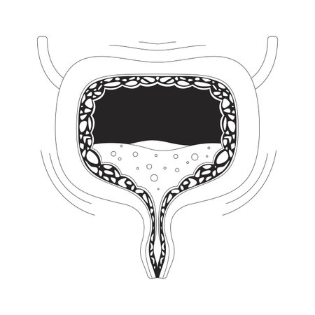 Overactive human bladder with urgency symptom outline illustration. Urinary incontinence, spasms. Trembling walls and urine buildup 2D line object isolated on white. Monochrome vector ink linear imageのイラスト素材