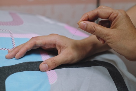 Needles point to hand for acupunctureの素材