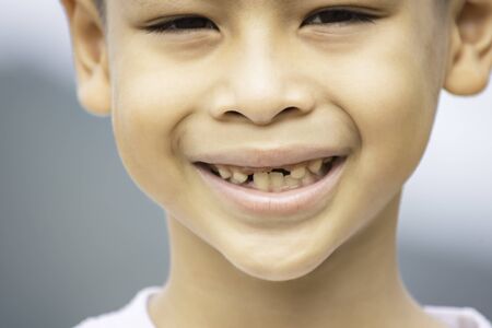 Baby teeth are just dropped in the mouth.の写真素材