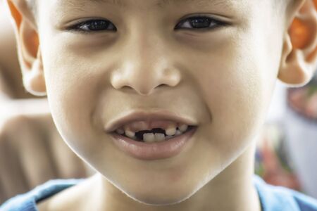Baby teeth are just dropped in the mouth.の写真素材