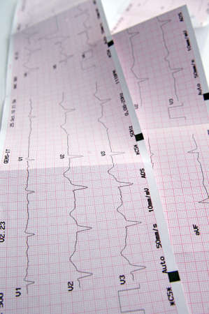 Cardiogram, ECG graphの写真素材