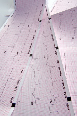 Cardiogram, ECG graphの写真素材