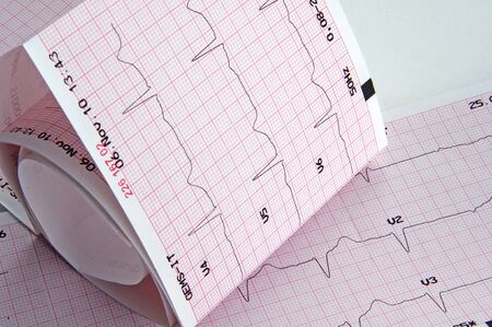 Cardiogram, ECG graphの写真素材