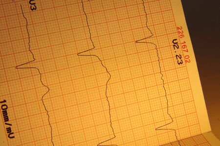 Cardiogram, ECG graphの写真素材