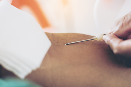 Preparation for blood donationsの写真素材