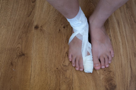 Plaster cast on the big toe of the child. Big toe after surgery. High quality photoの写真素材