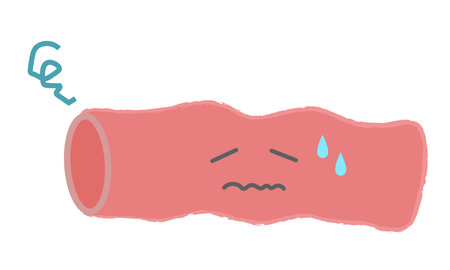 Illustration of weak blood vesselsのイラスト素材