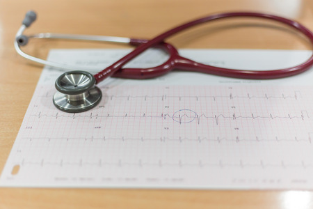 Closed-up of a Electrocardiograph also known as EKG or ECG graph with a stethoscope.の写真素材