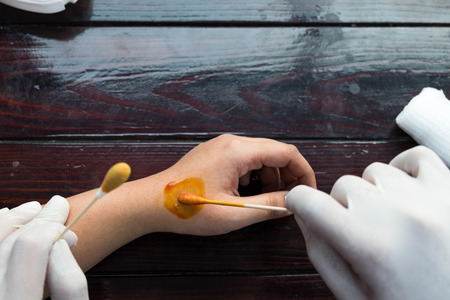 nurse being cure lesion on someone hand look like not problem on wooden table backgroundの写真素材