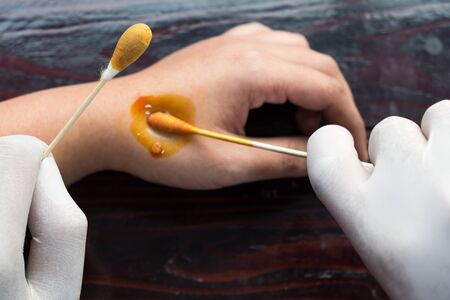 nurse being cure lesion on someone hand look like not problem on wooden table backgroundの写真素材