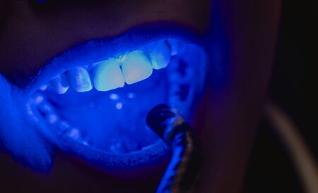Close-up pictures of the mouth that the dentist examines and fills the teeth of the patients in the clinic for better dental health and a bright smile.
の写真素材