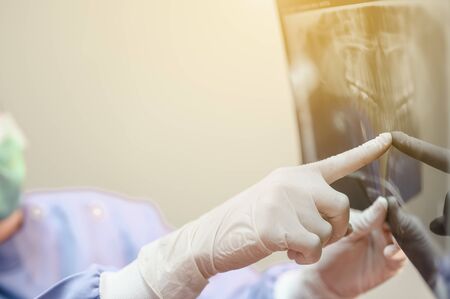 Image of female doctor holding and looking at dental x-ray of patients for an effective treatment and improves the patient's dental health and a bright smile.の写真素材