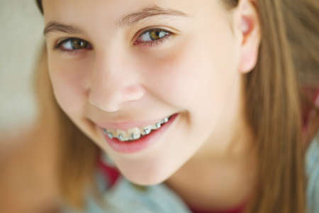 Close up portrait of smiling teenager girl showing dental braces.Isolated on white background. High quality photo.の写真素材