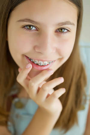 Close up portrait of smiling teenager girl showing dental braces.Isolated on white background. High quality photo.の写真素材