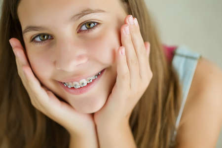 Close up portrait of smiling teenager girl showing dental braces.Isolated on white background. High quality photo.の写真素材