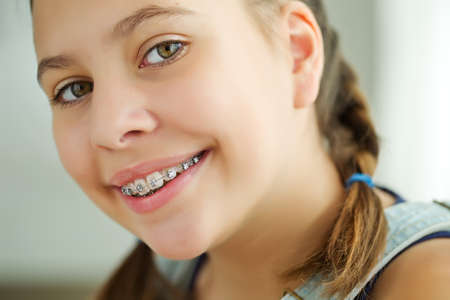 Close up portrait of smiling teenager girl showing dental braces.Isolated on white background. High quality photo.の写真素材