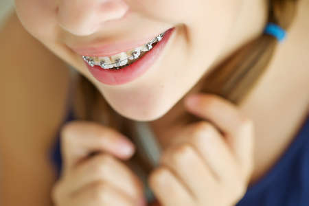 Close up portrait of smiling teenager girl showing dental braces.Isolated on white background. High quality photo.の写真素材