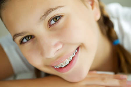 Close up portrait of smiling teenager girl showing dental braces.Isolated on white background. High quality photo.の写真素材
