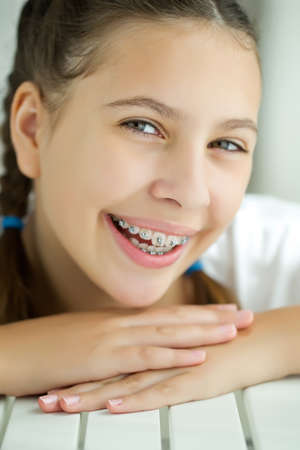 Close up portrait of smiling teenager girl showing dental braces.Isolated on white background. High quality photo.の写真素材