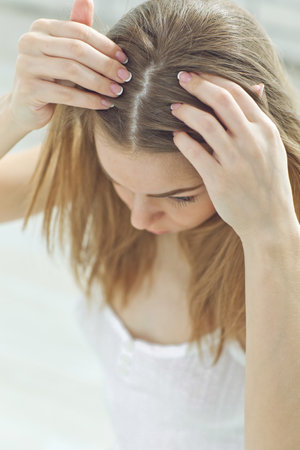 Young woman with hair loss problem on white background, closeup. Woman hair problem. High quality photoの写真素材