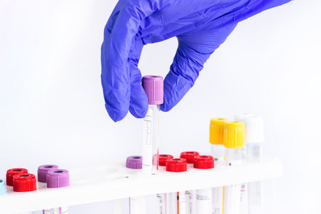 hands of a laboratory assistant with a blood sample and fortitude with blood samples . laboratory assistant holding a blood sample for researchの写真素材