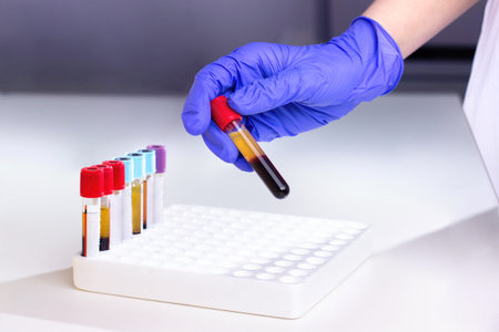 hands of a laboratory assistant with a blood sample and fortitude with blood samples . laboratory...