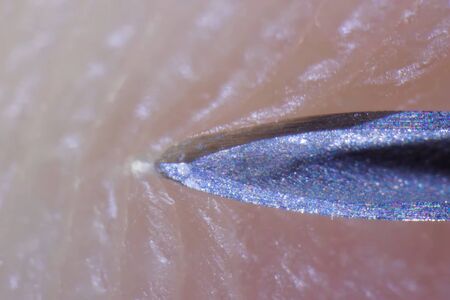 The end of a medical syringe needle enters human skin, Macro shot of a syringe needle.の写真素材
