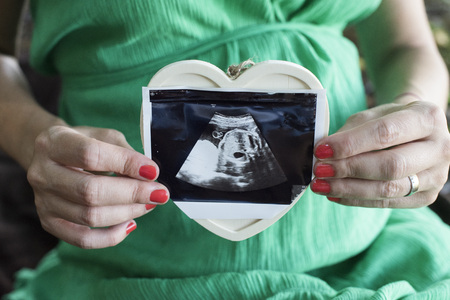 A pregnant woman with baby's ultrasound in her hands