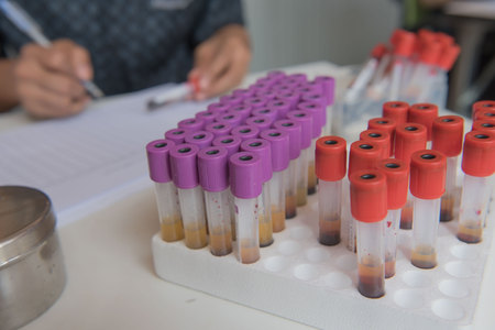 sample blood tube from patient  in Laboratory .の写真素材