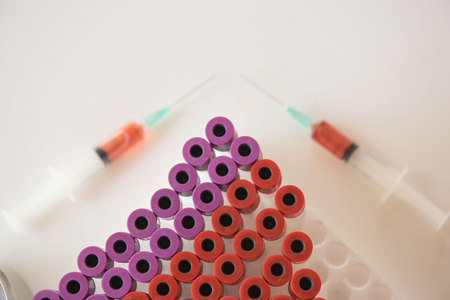 sample blood tube and syringe, cotton from patient  in Laboratory .の写真素材