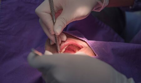 dental teeth patient by the dentist. Dentistry in hospital.