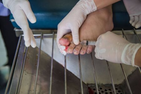 Anesthesia pain injections at patient's toes by a doctor in a hospital.の写真素材