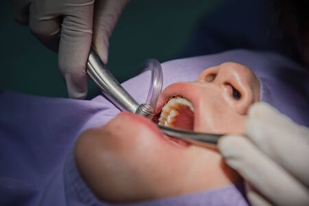 Teeth cleaning by the dentist. Dentistry in hospital.