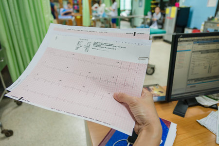 Heart analysis, electrocardiogram graph (ECG) in hand doctor at the hospital .の写真素材