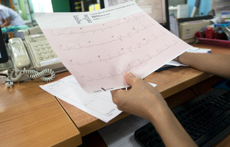 Heart analysis, electrocardiogram graph (ECG) in hand doctor at the hospital .の写真素材