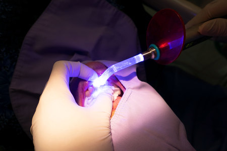 dental teeth patient by the dentist. Dentistry in hospital.の写真素材