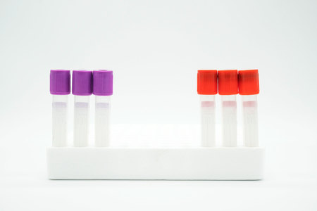 sample blood tube from patient  on white background . copy space , space for text and image . Medical equipment .の写真素材
