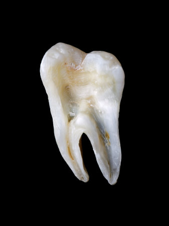 Longitudinal section from a human tooth isolated on black background