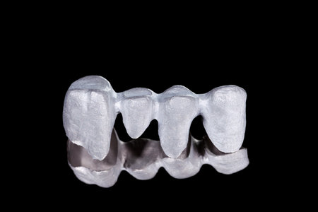 Dental metal framework bridge on isolated black backgroundの写真素材